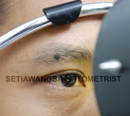 Pemeriksaan Mata Percuma di Setiawangsa Optometrist